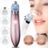 منظف مسام الوجه ومزيل الرؤوس السوداء الكهربائي XN-8030
